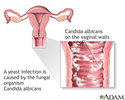 Stephanie Mcmahon In Bikini Clitoris yeast infection